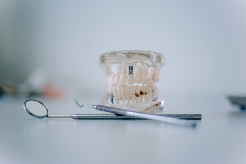Имплантация зубов - Стоматология Дентал