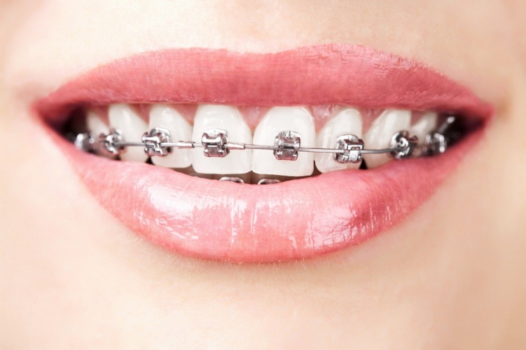 Ортодонтическая стоматология - Дентал